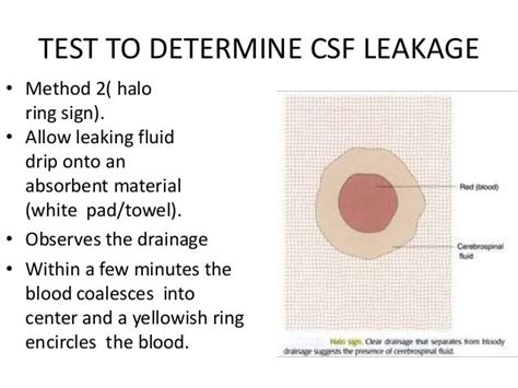 csf drop test|what is a csf scan.